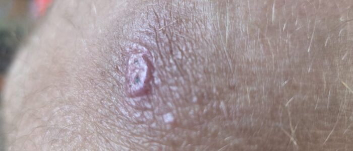 20250810_174108-scaled